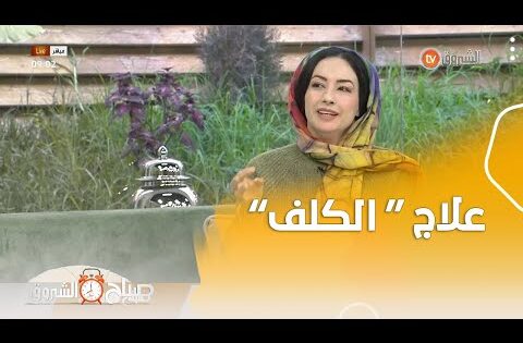 طبيبة في الامراض الجلدية ..هذا هو العلاج الوحيد  لـ"الكلف"