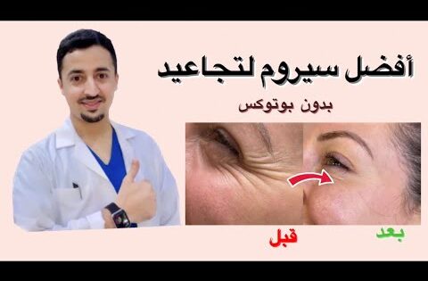 لإزالة التجاعيد وشد الوجه بأفضل سيروم بالصيدلية وبدون بوتوكس