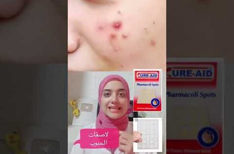 أسهل حل في خطوتين للتخلص من الحبوب المزعجة في الوجه في يوم واحد