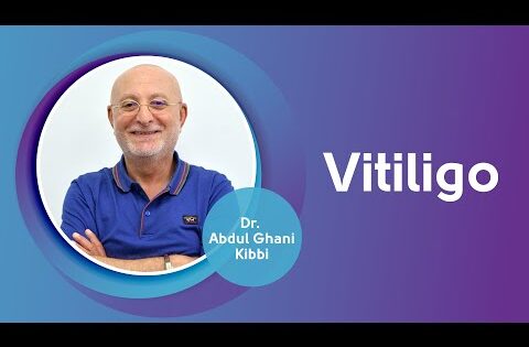 مرض البهاق، اسبابه وطرق علاجه مع الدكتور عبد الغني كبّي | Vitiligo, causes and treatments