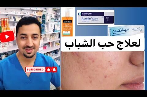 أفضل علاج حب الشباب واثارة