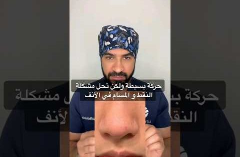 النقط السوداء في الانف حل نهائي للأبد