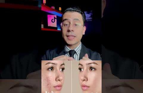 كريم السحر اللي هايغير بشرتك