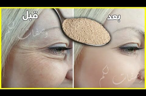 ماسك لإزالة التجاعيد🌵تحت العينين وتجاعيد الوجه🌹يجعل بشرتك مشدوده كأنك في سن العشرين، أقوى بوتوكس